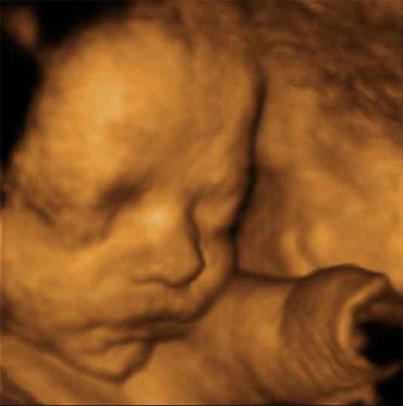 feto de 29 a 30 semanas, semana 31 a 32 semanas de embarazo